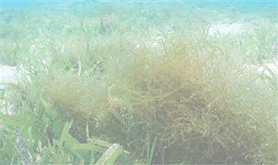 Fucoidan từ tảo biển có tác dụng như thế nào với sức khoẻ bệnh nhân ung thư?