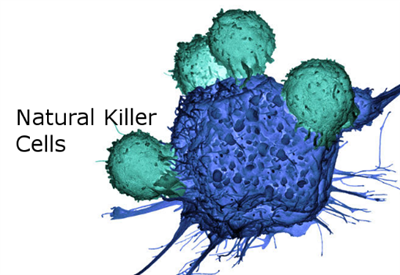 Tế bào giết tự nhiên (tế bào NK) - Vũ khí mạnh mẽ chống lại ung thư phổi tế bào nhỏ